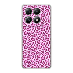 PINK LEOPARD - FLEX Case Xiaomi