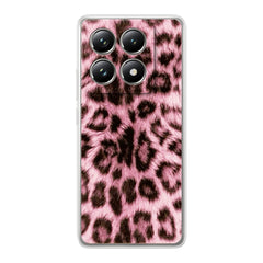 PINK LEOPARD FUR - FLEX Case Xiaomi